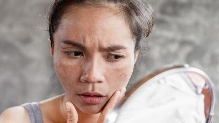 Rekomendasi 6 Essential Oil untuk Memudarkan Flek Hitam