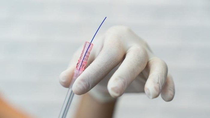 Apakah Tanam Benang Berbahaya? Coba Baca Dulu...