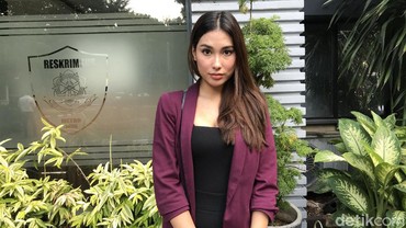 Wajah Memar Akibat Malapraktik, Frederika Cull Lapor Polisi