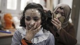 FOTO: Masker 3D untuk Sembuhkan Luka Bakar Sejumlah korban kebakaran kamp pengungsi Palestina di Gaza mengenakan masker 3D untuk menyembuhkan luka bakarnya. Masker berperan dalam mempercepat penyembuhan.