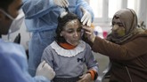 FOTO: Masker 3D untuk Sembuhkan Luka Bakar Sejumlah korban kebakaran kamp pengungsi Palestina di Gaza mengenakan masker 3D untuk menyembuhkan luka bakarnya. Masker berperan dalam mempercepat penyembuhan.