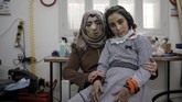 FOTO: Masker 3D untuk Sembuhkan Luka Bakar Sejumlah korban kebakaran kamp pengungsi Palestina di Gaza mengenakan masker 3D untuk menyembuhkan luka bakarnya. Masker berperan dalam mempercepat penyembuhan.