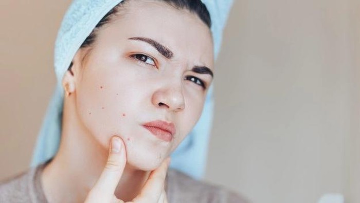 Teknik Buffering, Bikin Retinol di Wajah Minim Iritasi