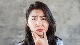 Mengenal Bell's Palsy: Gejala, Penyebab, dan Pengobatan