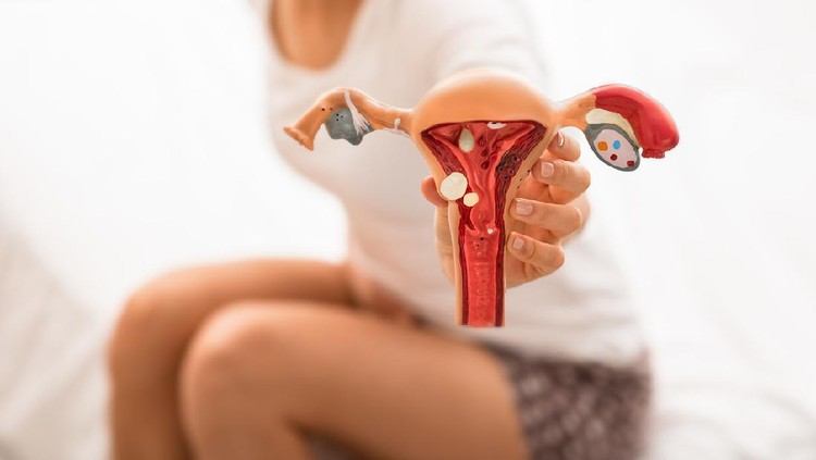 unrecognizing woman with abdominal pain holds the anatomical model of uterus and ovaries with pathology. diseases uterus and ovaries, endometriosis, ovarian cysts