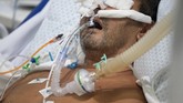 FOTO: Dihantam Varian Baru Corona, RS Brasil Nyaris Kolaps Hampir semua rumah sakit dan unit perawatan intensif (ICU) di Brasil tumbang akibat dihantam lonjakan kasus varian baru virus corona.