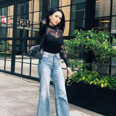 Muncul Benang di Kepala, Anggita Sari Merasa Jadi Korban Malpraktik