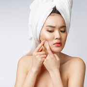 Mengenal Jerawat Hormonal dan Cara Mengatasinya