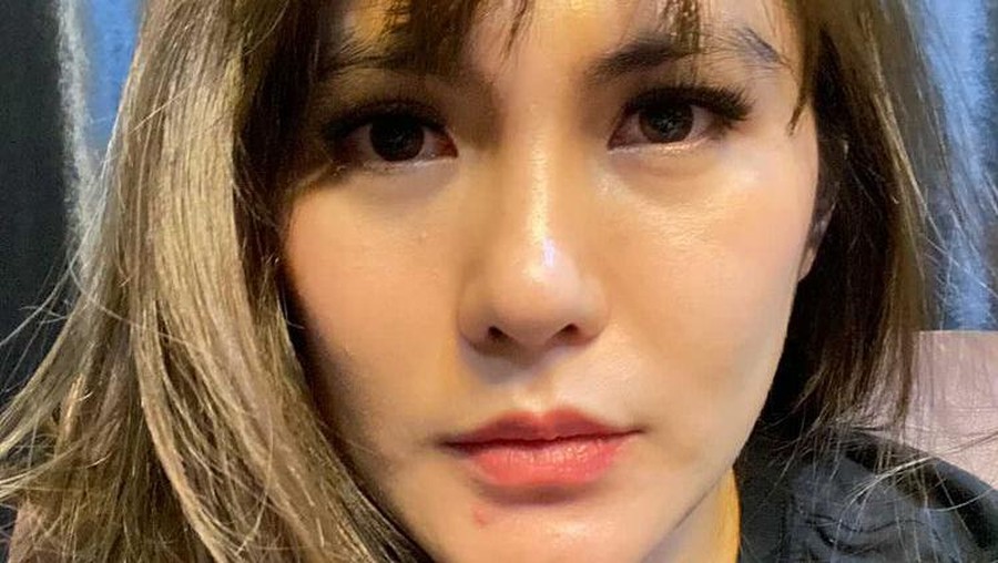Angela Lee operasi hidung