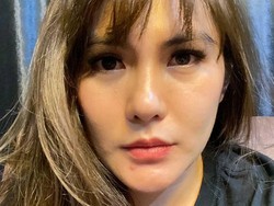 Wajah Angela Lee Sempat Membengkak Usai Operasi Hidung