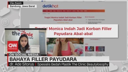 Video Bahaya Filler Payudara