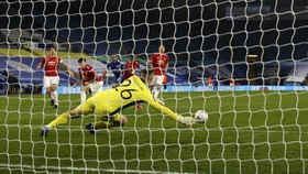 Irene Bantah Pansos Dewa Kipas, Man Utd Kalah di Piala FA