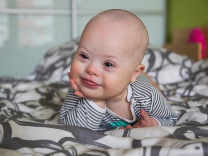 Teh Hijau Bermanfaat untuk Anak Down Syndrome? Ini Kata Peneliti
