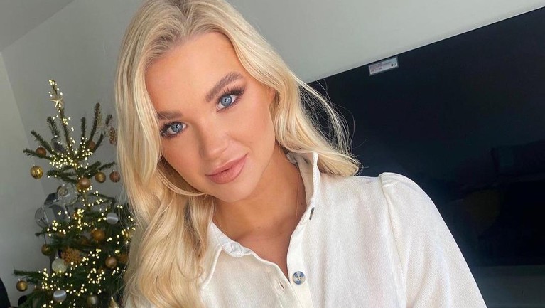 Beginilah potret wajah cantik penari asal Inggris Abbie Quinnen sebelum terkena bola api.