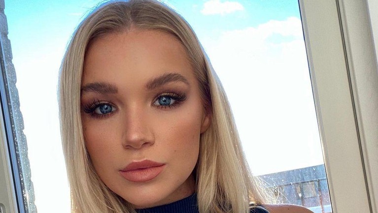 Beginilah potret wajah cantik penari asal Inggris Abbie Quinnen sebelum terkena bola api.