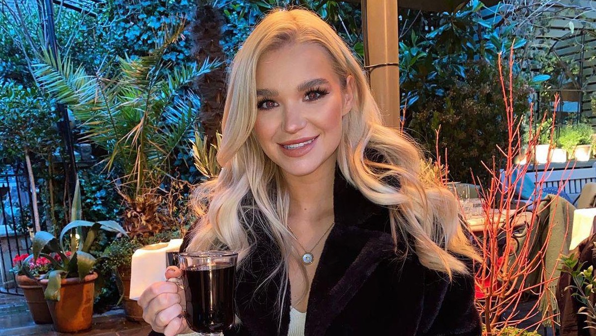 Beginilah potret wajah cantik penari asal Inggris Abbie Quinnen sebelum terkena bola api&period;