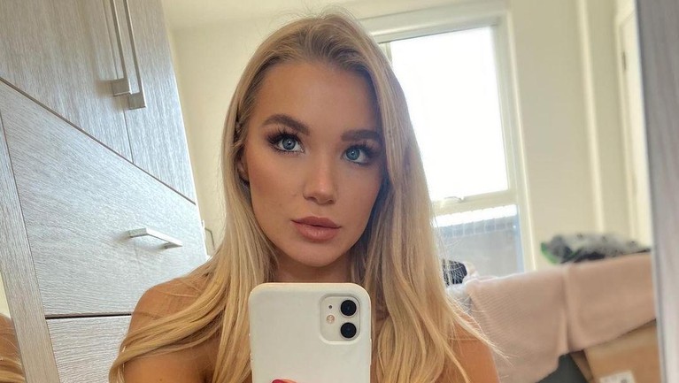 Beginilah potret wajah cantik penari asal Inggris Abbie Quinnen sebelum terkena bola api.