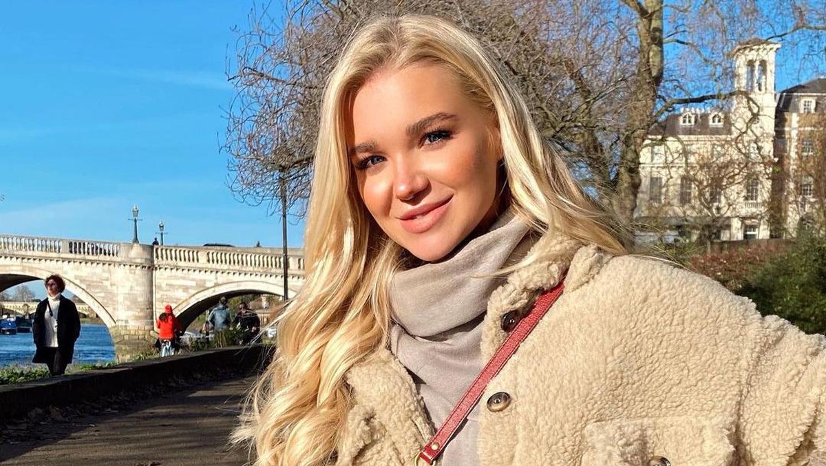 Beginilah potret wajah cantik penari asal Inggris Abbie Quinnen sebelum terkena bola api&period;