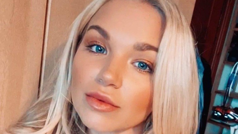 Beginilah potret wajah cantik penari asal Inggris Abbie Quinnen sebelum terkena bola api.