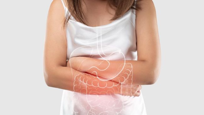 Dalam beberapa waktu ke belakang viral soal foto rontgen usus yang terlihat naik ke dada. Dokter menjelaskan kondisi tersebut sebagai redundant colon.