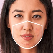 6 Langkah Tepat Merawat Kulit Maskne, Gak Ganggu Lagi!