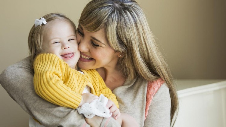 Mother (20s) holding daughter (2 years) with down syndrome.