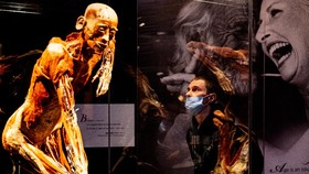 FOTO: Pameran Mayat Manusia di Rusia yang Tuai Polemik