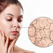 Pengertian Skin Barrier dan Bagaimana Cara Menjaganya