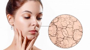 Pengertian Skin Barrier dan Bagaimana Cara Menjaganya