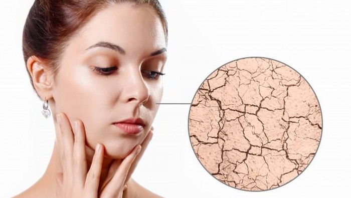 Pengertian Skin Barrier dan Bagaimana Cara Menjaganya Pengertian Skin Barrier dan Bagaimana Cara Menjaganya