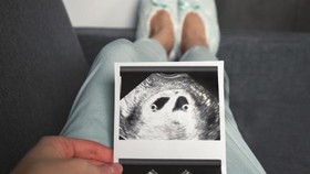 Sempat Dilakukan Luna Maya di 2021, Apa itu Egg Freezing?