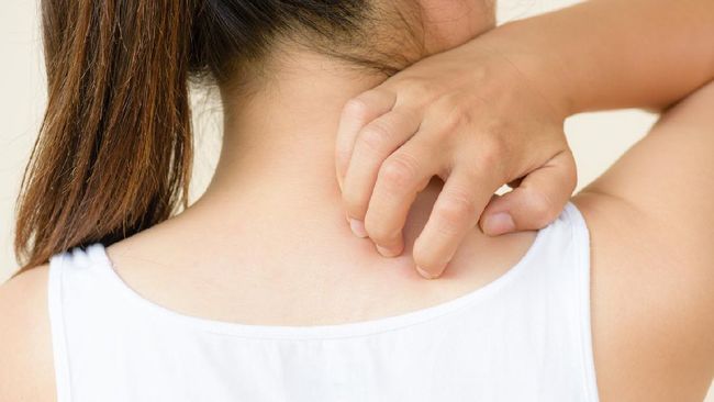 Selain penggunaan obat medis, cara alami bisa diterapkan untuk mengatasi kulit gatal salah satunya dengan menggunakan daun herbal.