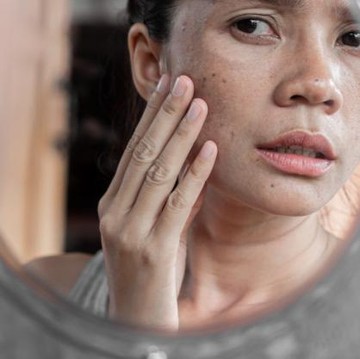 img-title Berhenti Sekarang Juga! 5 Beauty Hacks Populer Ini Ternyata Cuma Mitos, Bahkan Bisa Merusak Kulit!