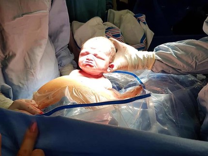 Dahulu Viral karena Lahir dengan Muka Cemberut, Ini Wajah Sang Bayi Sekarang