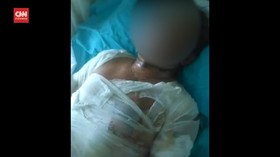 VIDEO: Sepasang Suami Istri Dibakar Tetangga