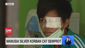 VIDEO: Manusia Silver Korban Cat Semprot