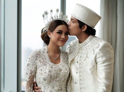 6 Skincare Aurel Hermansyah yang Resmi Jadi Istri Atta Halilintar