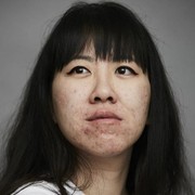 Bekas Jerawat Ternyata Ada Jenisnya, Cek Untuk Tahu Bedanya!