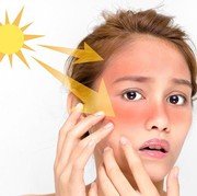 Sunburn? Atasi dengan 6 Cara Ini Yuk!