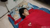 Mengenal Hipersomnia yang Dialami Echa si 'Putri Tidur' dari Banjarmasin