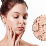 Perbedaan Kulit Kering dan Kulit Dehidrasi, Yuk Cari Tahu!