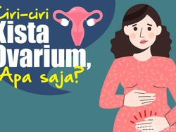 Ciri-ciri Kista Ovarium Seperti yang Sempat Diidap Aurel Hermansyah
