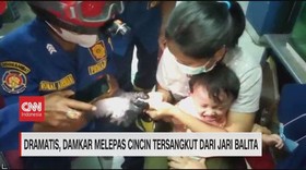 VIDEO: Pelepasan Cincin Tersangkut di Jari Balita