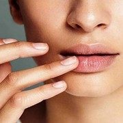 Tips Ampuh Atasi Bibir Kering Selama Puasa