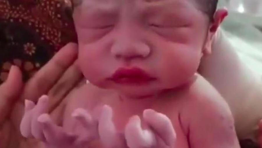 Viral Bayi Baru Lahir Menadahkan Tangan Viral Bayi Baru Lahir Menadahkan Tangan