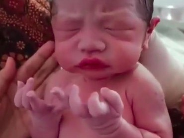 Bikin Merinding, 3 Kejadian Tidak Biasa Kelahiran Bayi di Dunia