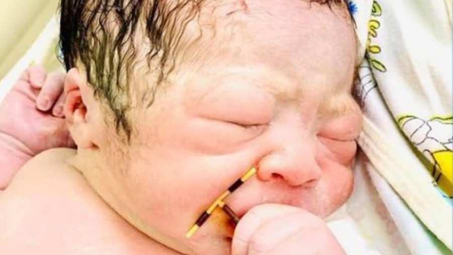 Bayi Pegang Kontrasepsi Bayi Pegang Kontrasepsi