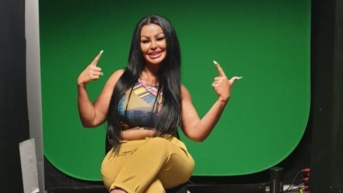 Kisah Wanita yang Habiskan Rp5 Miliar Demi 8 Kali Operasi Payudara