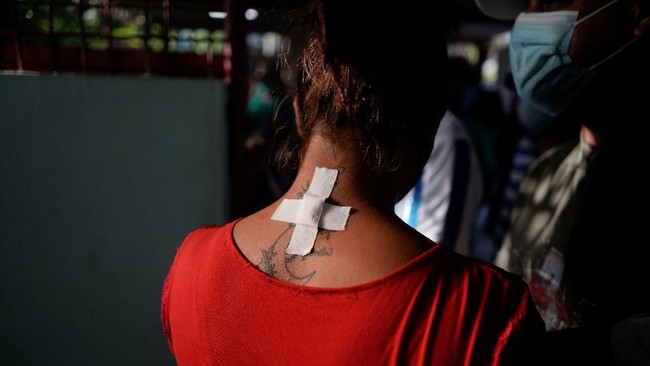 FOTO: Operasi Ekstrem Goliat dengan Parang 45 cm