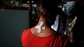 FOTO: Operasi Ekstrem Goliat dengan Parang 45 cm Temui Jorge Goliat, seorang